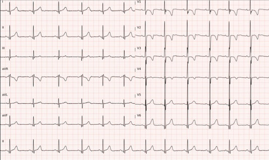 🫀 Prenota il tuo Elettrocardiogramma (ECG) in Farmacia