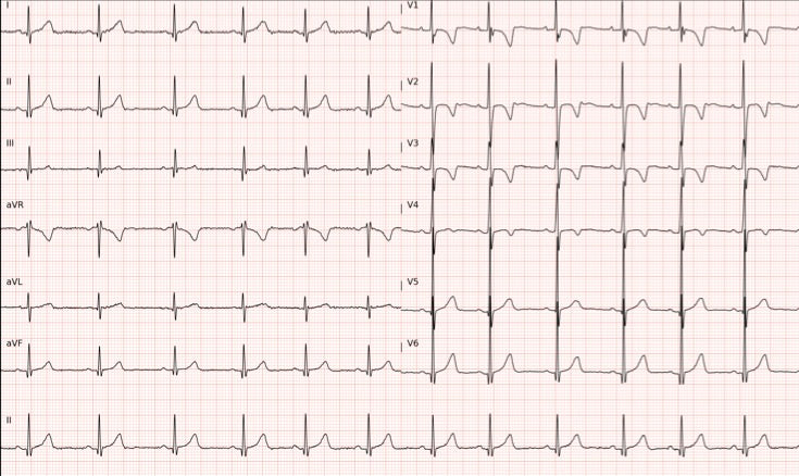 🫀 Prenota il tuo Elettrocardiogramma (ECG) in Farmacia